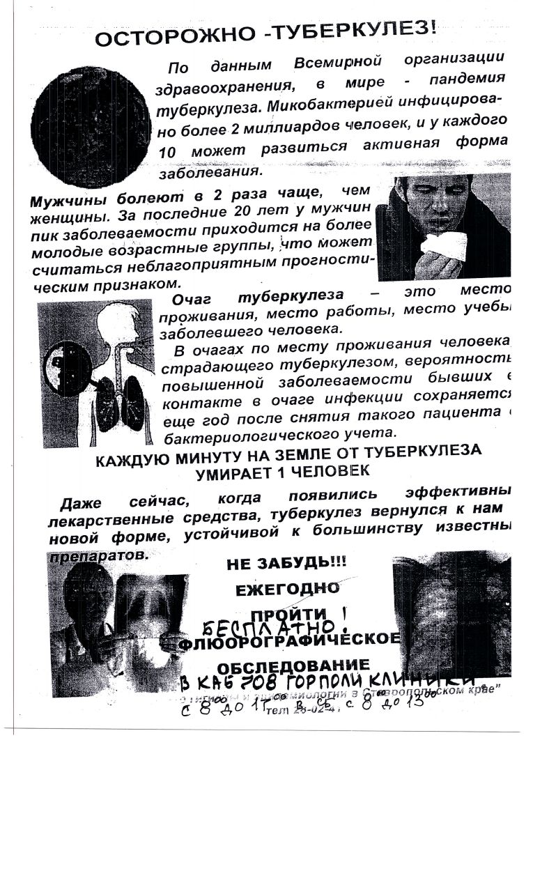 Туберкулез.