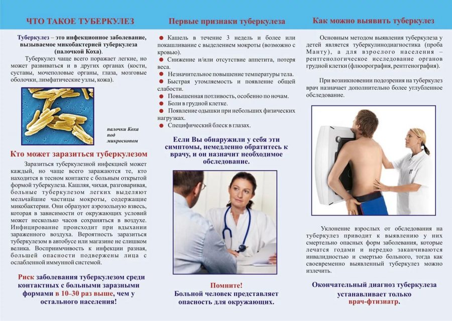 Туберкулез.